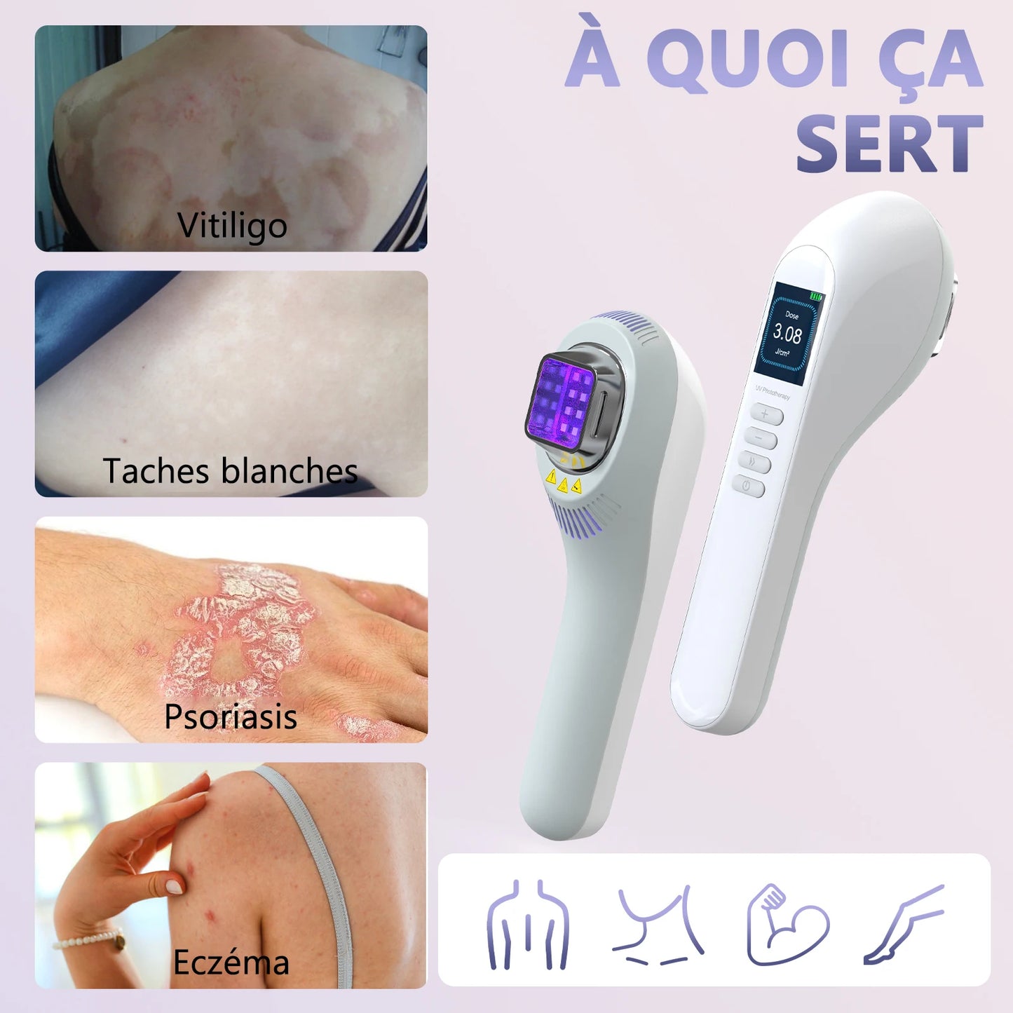 Lampe UVB 308nm pour Vitiligo, Psoriasis, Eczéma – Photothérapie à Domicile