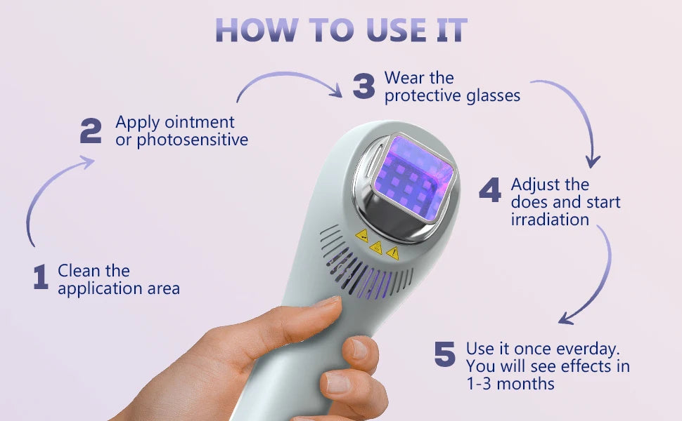 Lampe UVB 308nm pour Vitiligo, Psoriasis, Eczéma – Photothérapie à Domicile