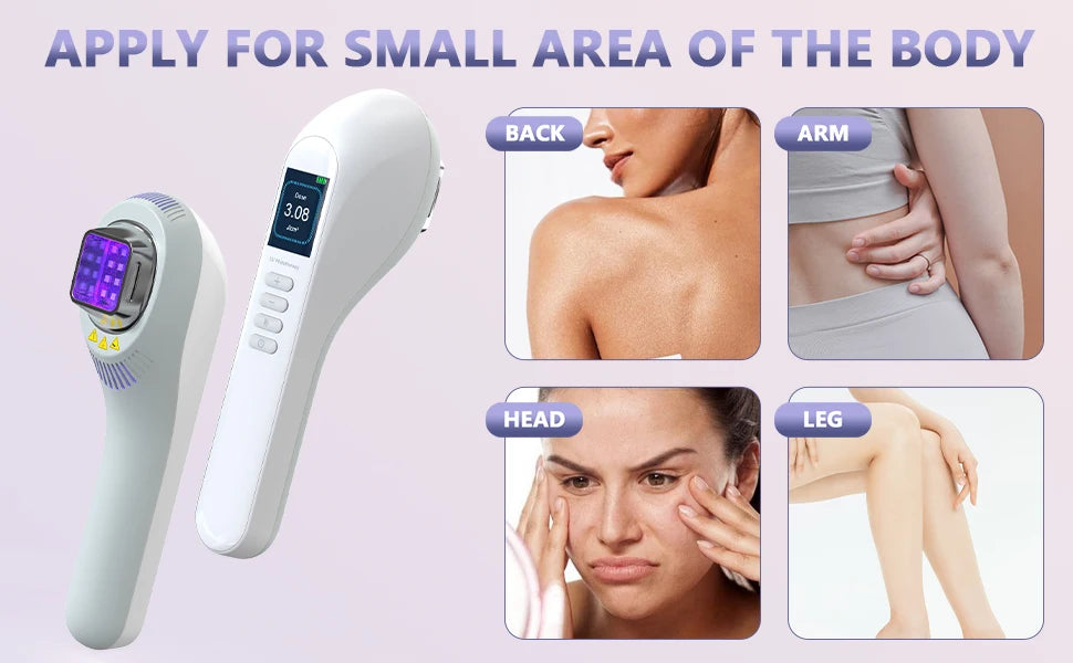Lampe UVB 308nm pour Vitiligo, Psoriasis, Eczéma – Photothérapie à Domicile
