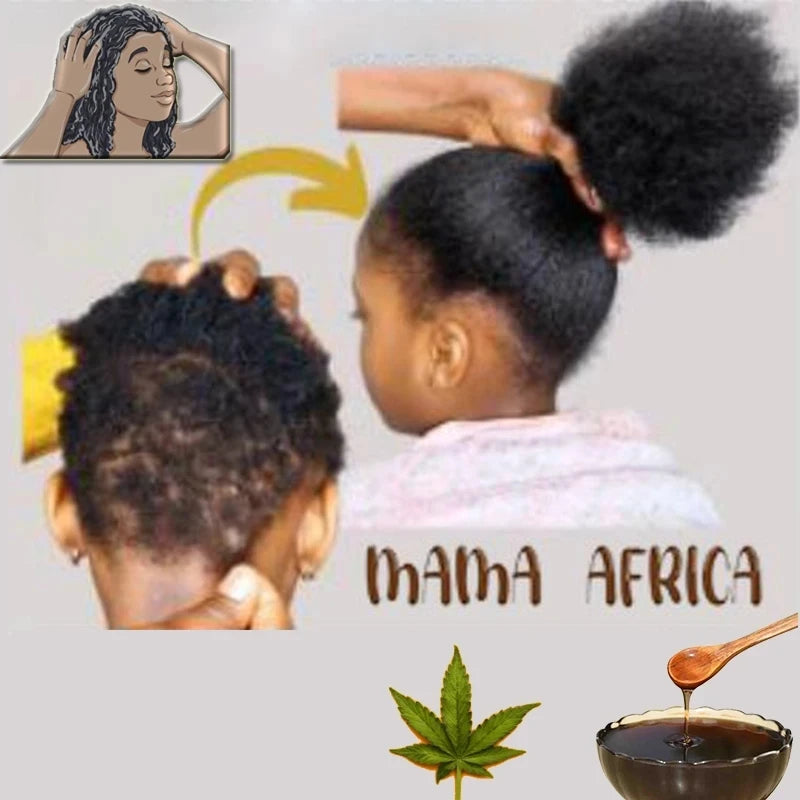 Shampooing Traction Alopécie – 300ml, Traitement Croissance Capillaire pour Femmes & Hommes