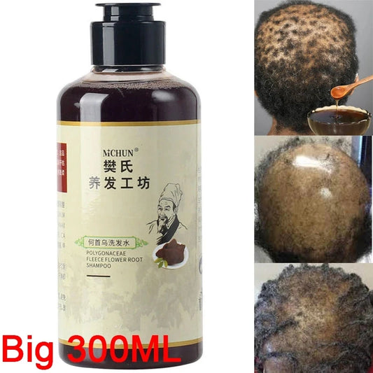 Shampooing Traction Alopécie – 300ml, Traitement Croissance Capillaire pour Femmes & Hommes