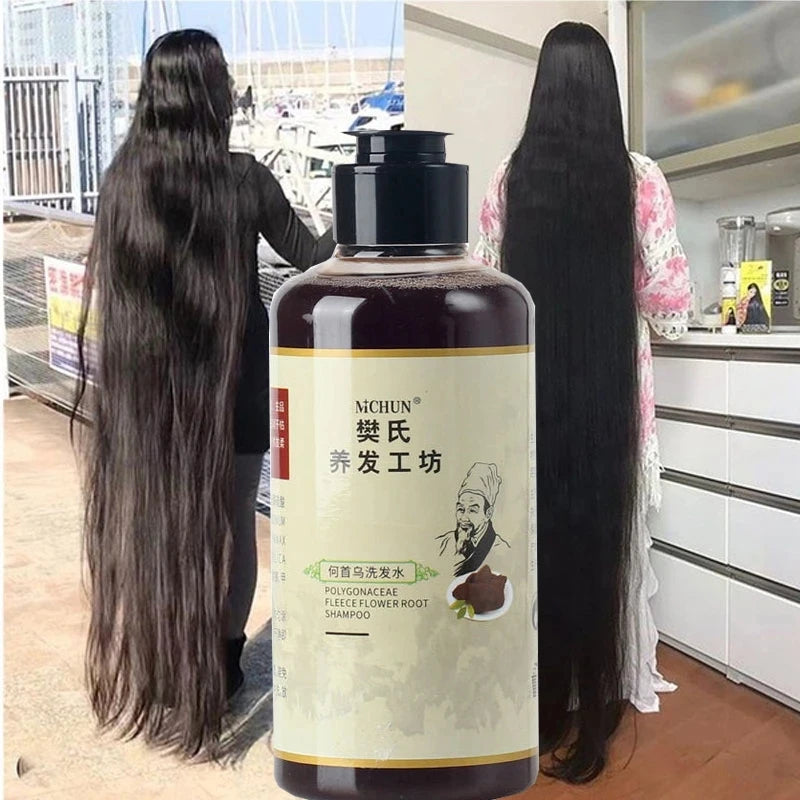 Shampooing Traction Alopécie – 300ml, Traitement Croissance Capillaire pour Femmes & Hommes